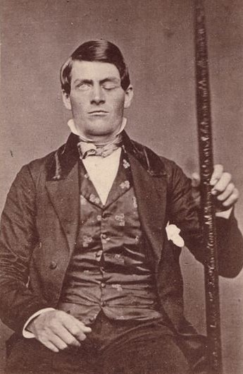 A cabinet-card portrait of Phineas Gage